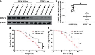 Inhibition of SREBP-1 Activation by a Novel Small-Molecule Inhibitor Enhances the Sensitivity of Hepatocellular Carcinoma Tissue to Radiofrequency Ablation